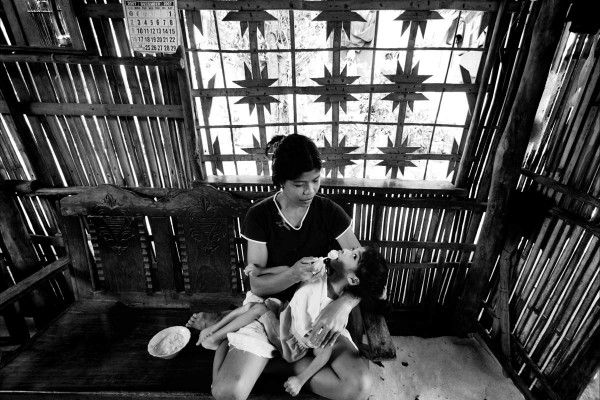 Maria Neryl Pigquerra, one of three children born in 2002 in Calancan Bay with microcephalis.